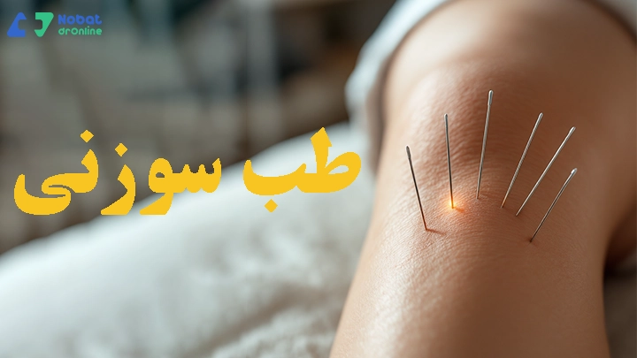 طب سوزنی