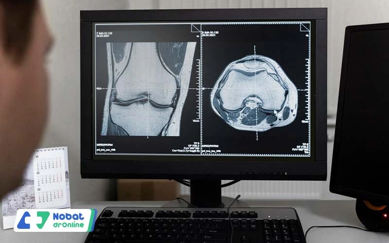 تصویر ام آر آی (MRI) پشت زانو | نوبت دکتر آنلاین