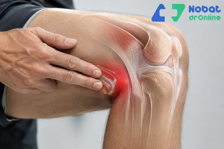 بهترین پماد برای مسکن زانودرد
